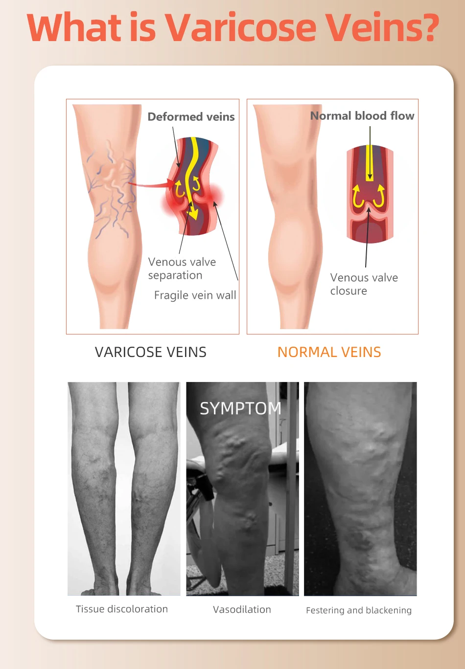 30–40 mmHg über dem Knie, gesc – Compression Sock Medical Bewertung und Preis